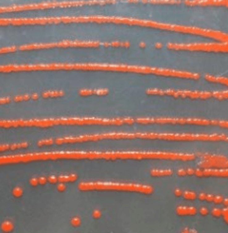 Von Bakterien produzierter Farbstoff in der Petrischale (c) karin Fleck - Vienna Textile Lab